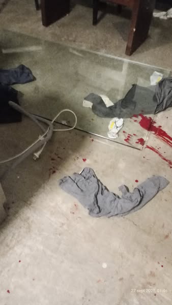 Violento episodio en City Bell: un hombre herido tras ataque de su pareja 